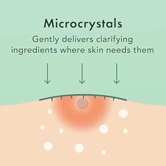 Rael Microneedle Acne Healing Patch - Pimple Acne Spot Tea Tree Treatment (2 Pack, 18 Patches)