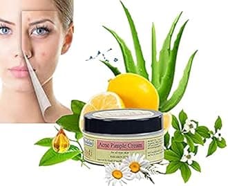 Khadi Rishikesh Ayurvedic Acne Pimple Remover Face Cream For Ane Scars & Pimple Marks Remove Cream-Best Cream For Pimple Remover-Skin Soft & Smooth.-UNISEX-50GM