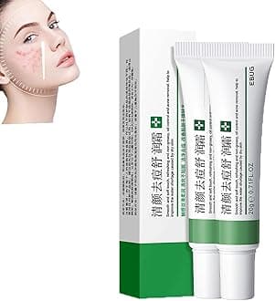 Whitening Freckle Cream,Acne Scar Removal Treatment Cream,Pigmentation Removal Cream For Face,Remove Melasma Acne Cream Fading Spot Cream,Dark Spot Corrector For Face (3PCS,Acne Relief)