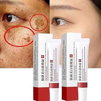 2PCS Spot-Off Freckle Whitening Cream,Scar Removal Treatment Cream,Dark Spot Corrector Cream,Pigmentation Removal Cream for Face,Freckle Remover Cream,Moisturizing Anti-blemish Skin Whitening Cream