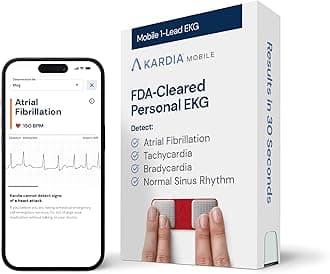 KardiaMobile 1-Lead Personal EKG Monitor – Record at Home – Detects AFib & Irregular Arrhythmias – Easy Results in 30 Seconds – Works w/Most Smartphones - FSA/HSA Eligible